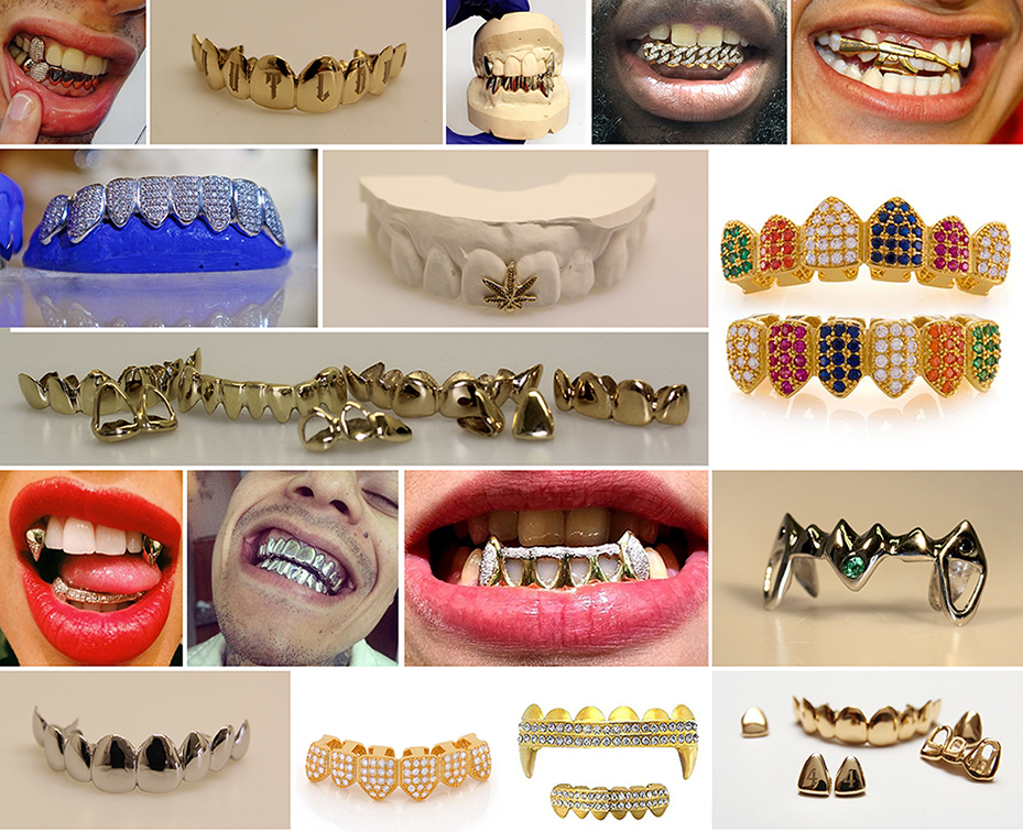 Son los grillz la nueva joya dental de las estrellas 1 son los grillz la nueva joya dental de las estrellas